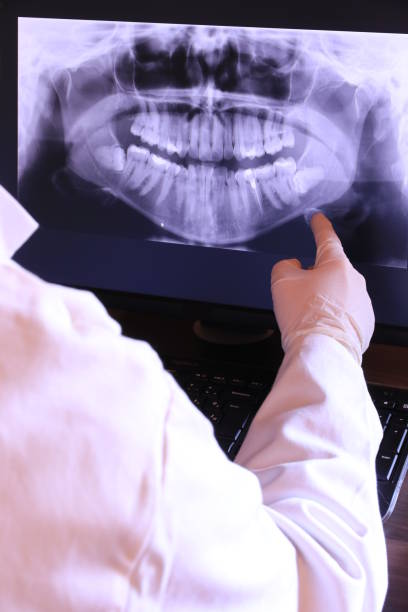 Best Emergency Dental Care for Broken or Chipped Teeth in Pleasant Hill, IA